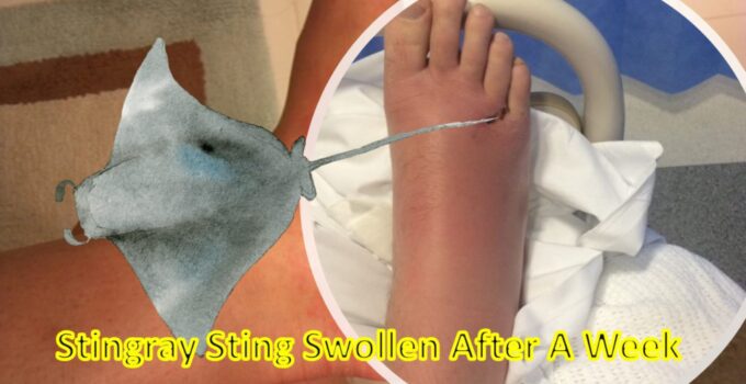 Stingray Sting Swollen After A Week