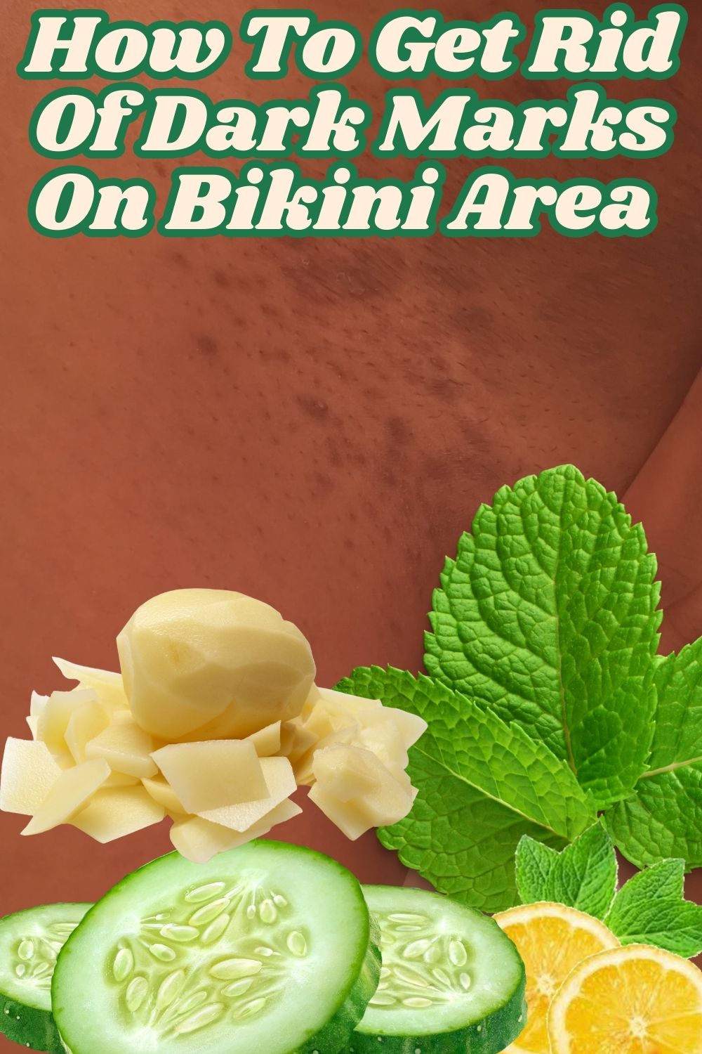 How To Get Rid Of Dark Marks On Bikini Area